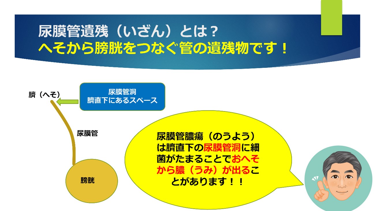 尿膜管膿瘍 のうよう 臍炎 さいえん おへそから膿がでる おへそが痛い 佐々木クリニック泌尿器科 芝大門 浜松町 港区 東京都